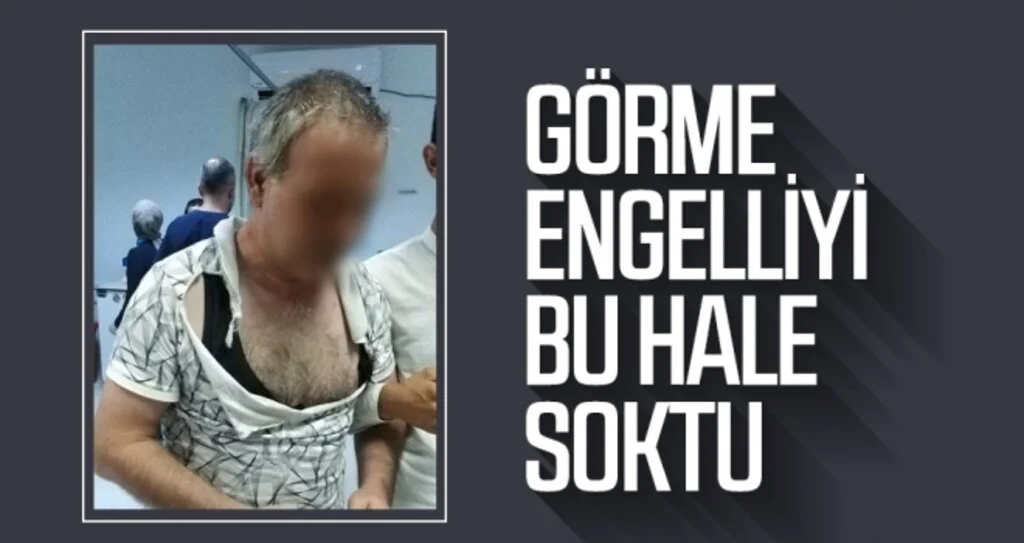 Görme engelliyi bu hale soktu