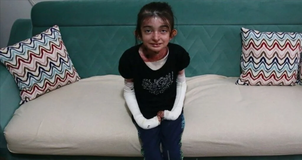 'Kelebek çocuk Elfida' hasta çocuklara yaşama azmini bıraktı