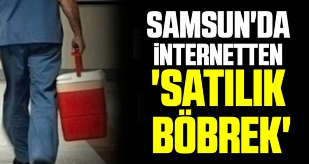 Samsun'da İnternetten 'Satılık Böbrek'