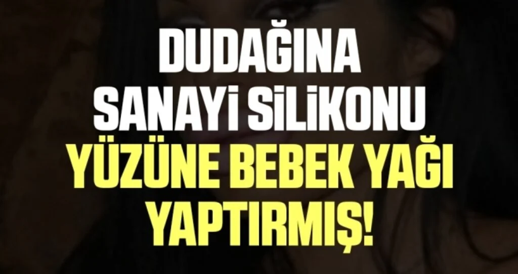 Dudağına sanayi silikonu, yüzüne bebek yağı yaptırmış!