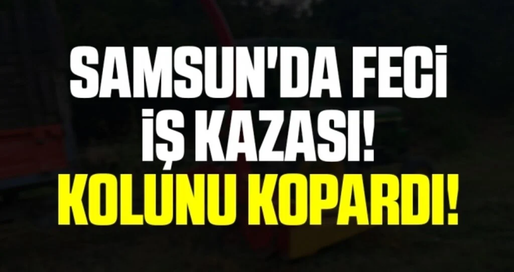Samsun'da Feci İş Kazası! Kolunu Kopardı!