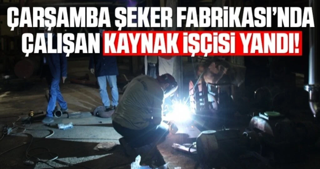 Çarşamba Şeker Fabrikası’nda Çalışan Kaynak İşçisi Yanarak Ağır Yaralandı
