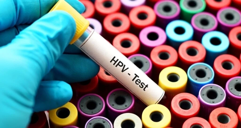 HPV Testi Nedir? Neden Önemlidir?