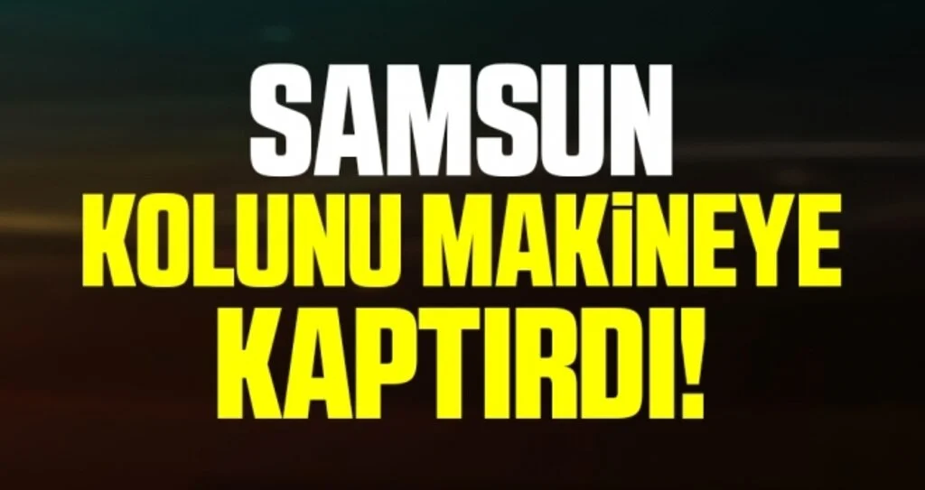 Samsun Kolunu Makineye Kaptırdı!