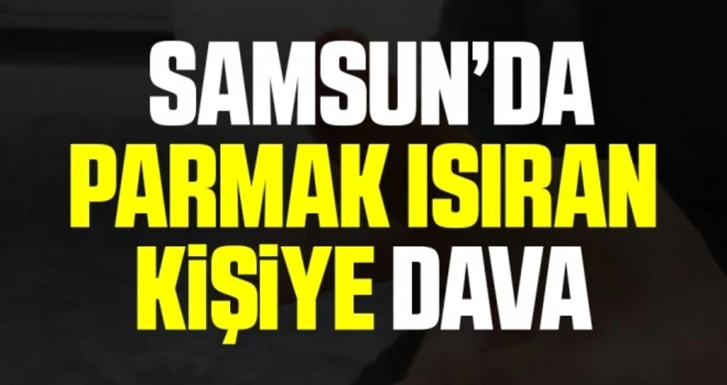 Samsun'da Parmak ısıran kişiye dava 