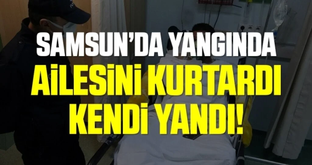 Samsun'da Yangında ailesini yanmaktan kurtardı, kendisi yanarak hastanelik oldu