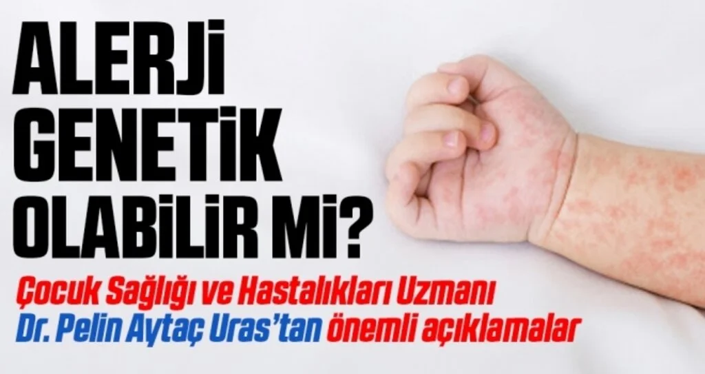 Alerji genetik olabilir mi? Çocuk Sağlığı ve Hastalıkları Uzmanı Dr. Pelin Aytaç Uras’tan önemli açıklamalar