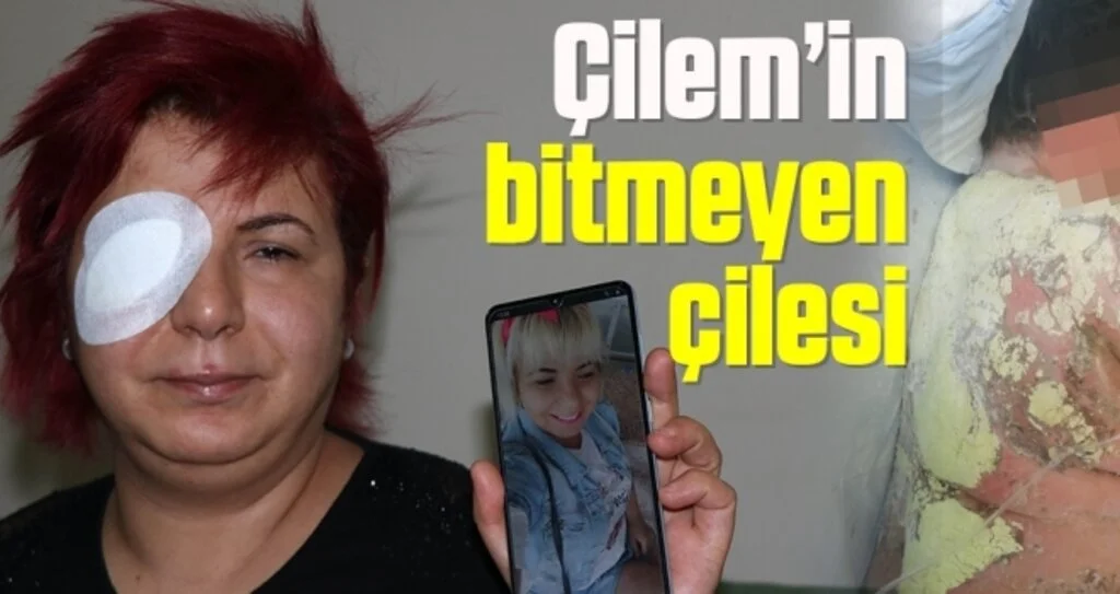 Çilem’in bitmeyen çilesi