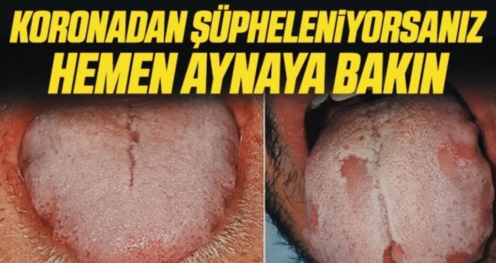 Koronadan şüpheleniyorsanız hemen aynaya bakın!