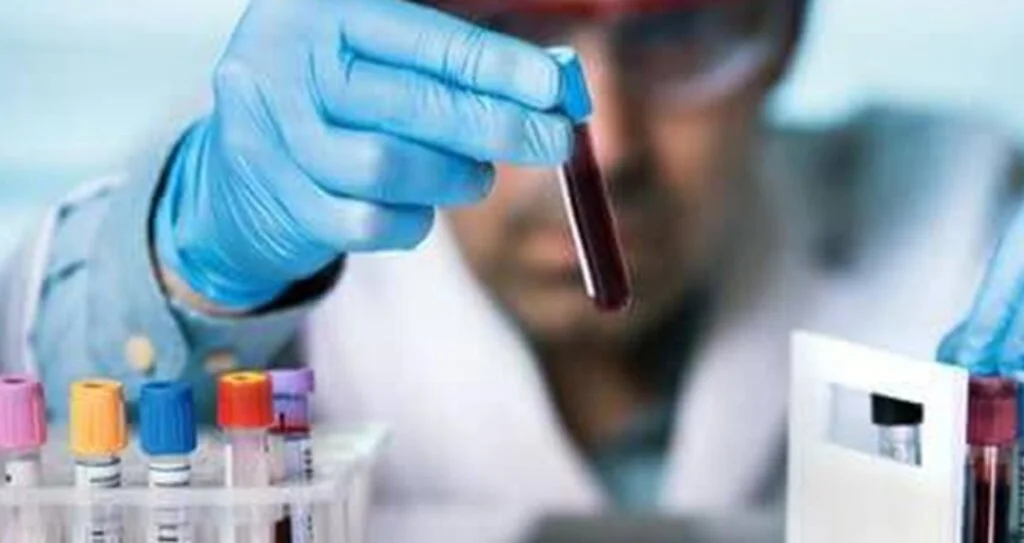 Moleküler Alerji Testi İle Alerjik Şok (Anafilaksi) Nedenleri Çok Ayrıntılı Ortaya Çıkarılabilir