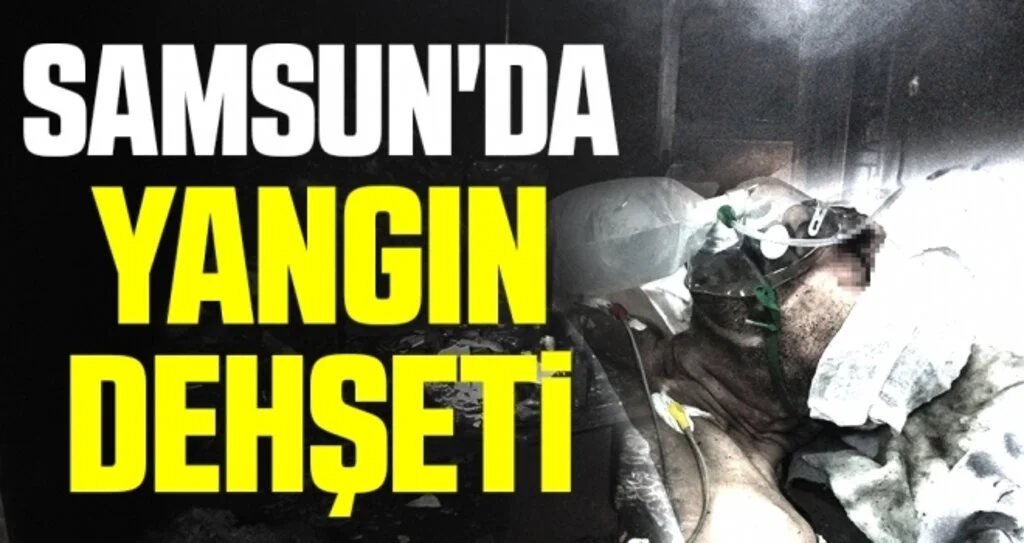 Samsun'da yangın dehşeti: Karı-koca ağır yaralandı