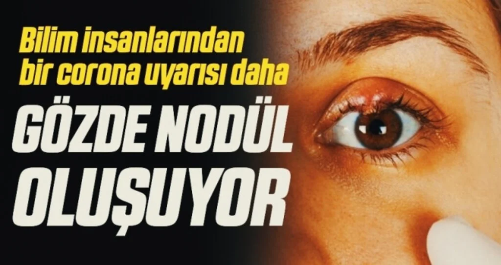 Bilim insanlarından corona uyarısı: Gözlerde nodül oluşuyor
