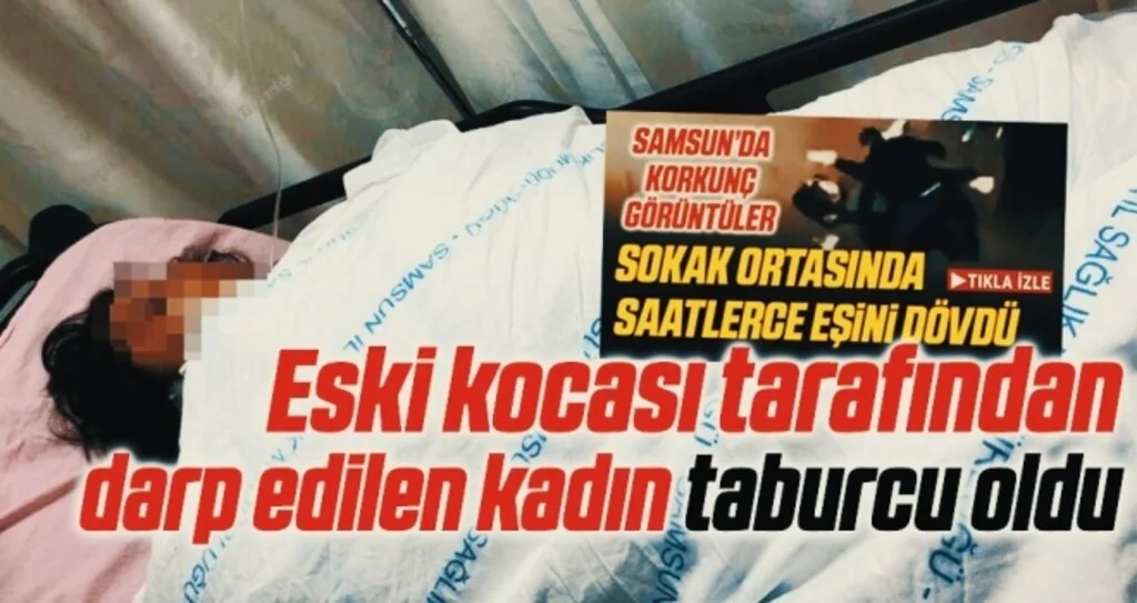Samsun'da Eski kocası tarafından darp edilen kadın taburcu oldu