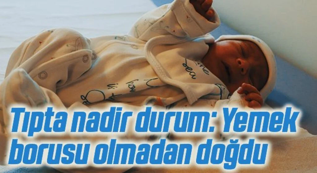 Tıpta nadir durum: Yemek borusu olmadan doğdu