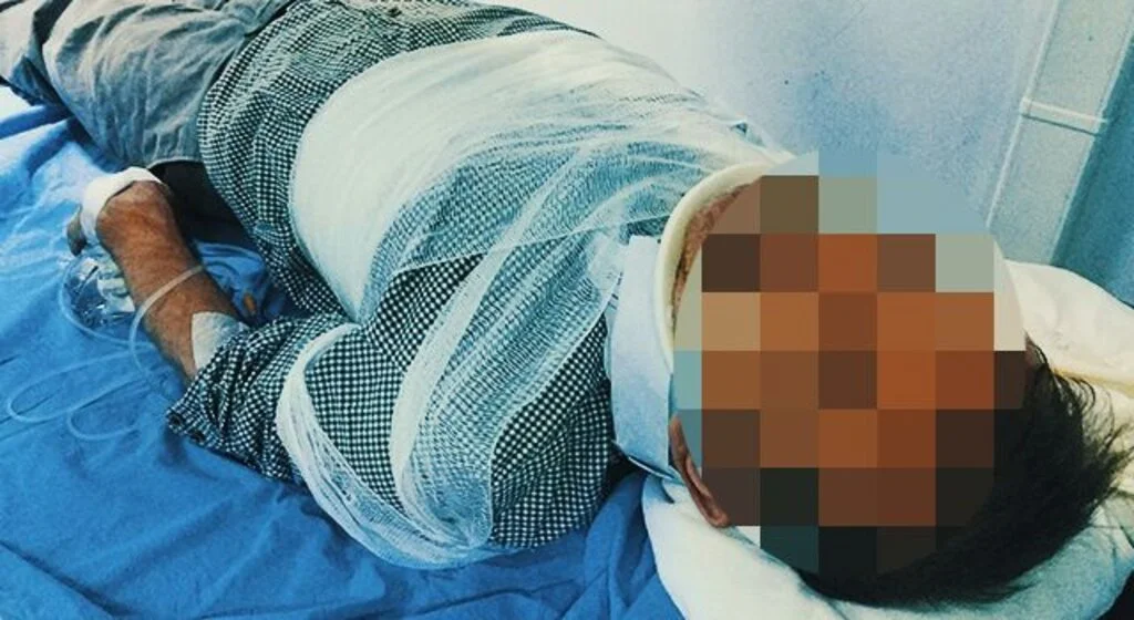 Ihlamur toplamak isterken ağaçtan düşerek hastanelik oldu