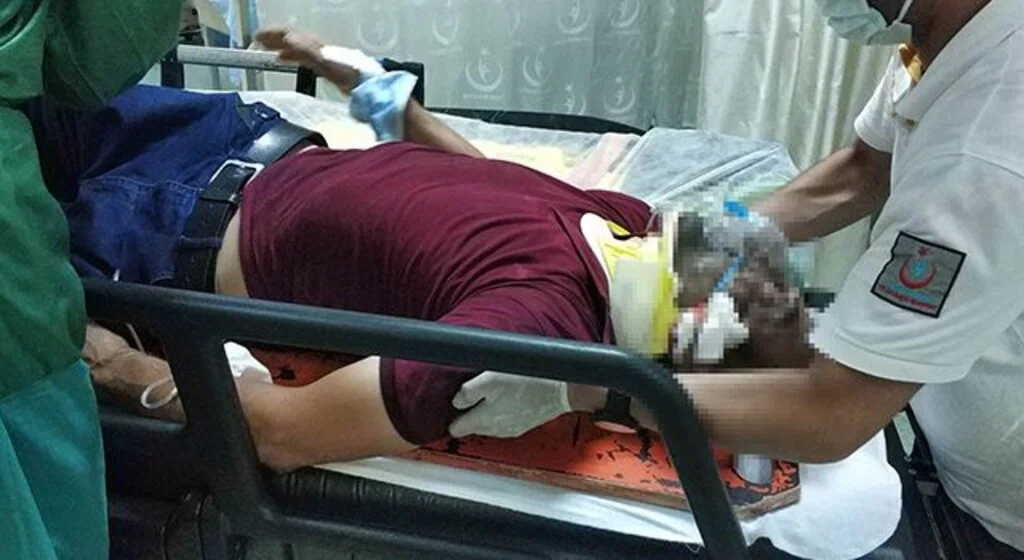 Samsun'da trafik kazası: 1 yaralı