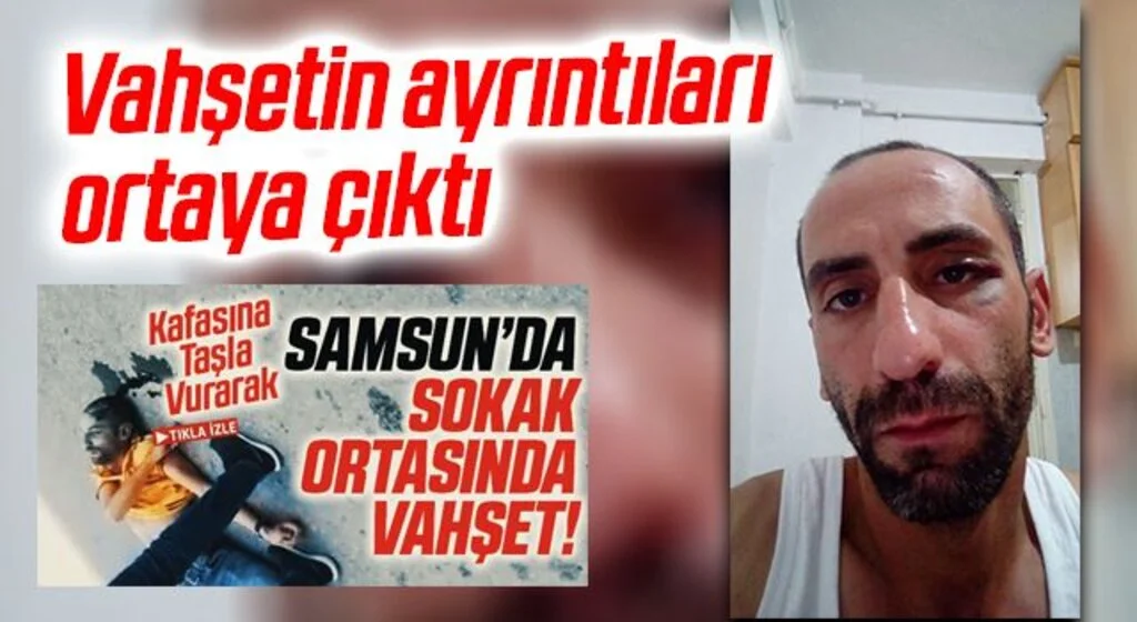 Vahşetin ayrıntıları ortaya çıktı