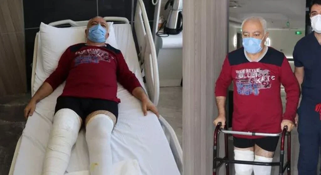 Diz ağrısı için gitti, duyduklarına inanamadı! Hakkında bilimsel makale hazırlanacak