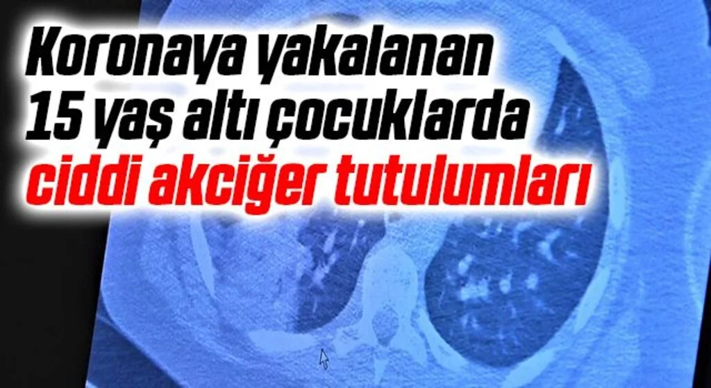 Koronaya yakalanan 15 yaş altı çocuklarda ciddi akciğer tutulumları