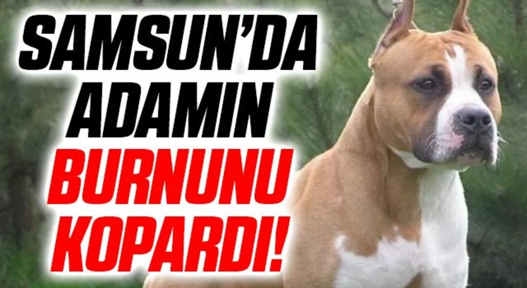 Samsun'da Pitbull Adamın Burnunu Kopardı!