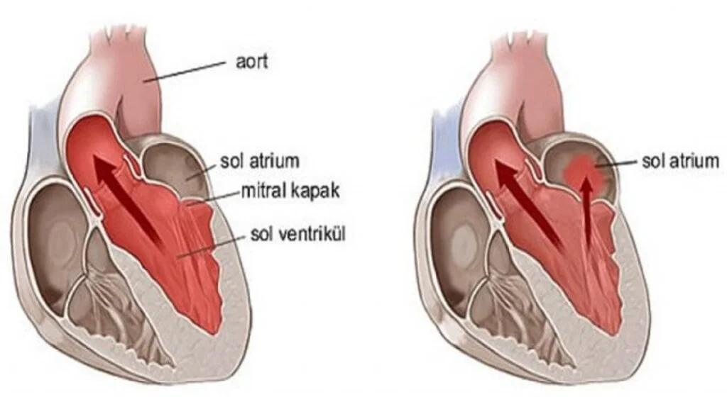 Kalbin içindeki mucize: Mitral kapak