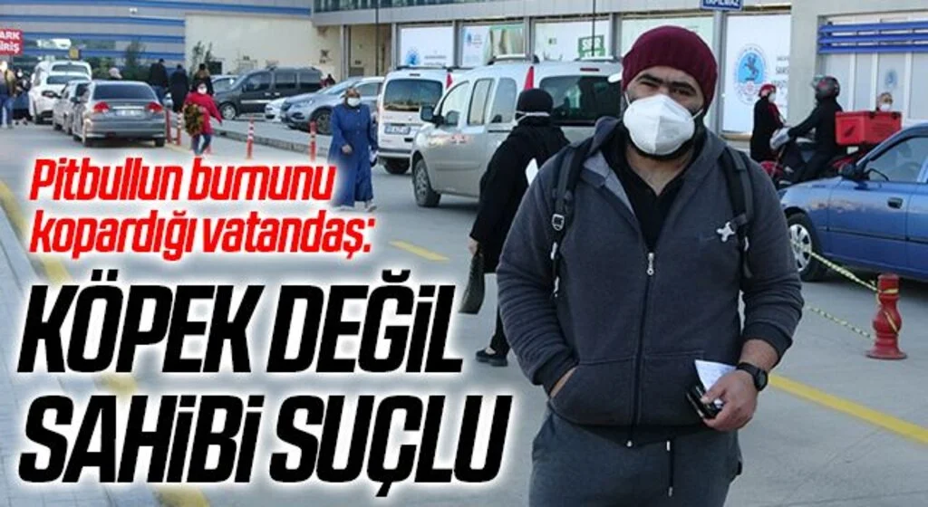 Pitbullun burnunu kopardığı vatandaş: Köpek değil sahibi suçlu