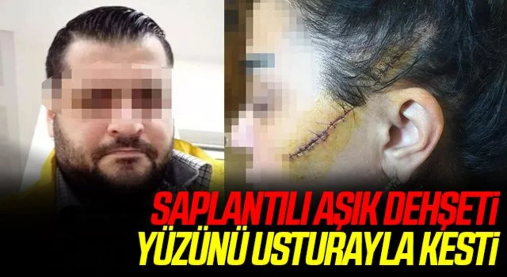 Saplantılı aşık dehşeti: Eski sevgilisinin yüzünü usturayla kesti, sosyal medyadan "Herkese elveda yakalandım" yazdı