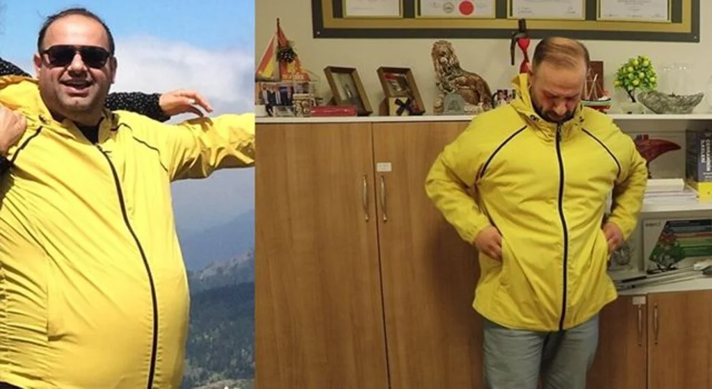 1,5 yılda 55 kilo verdi, 140 kilodan 85 kiloya düştü