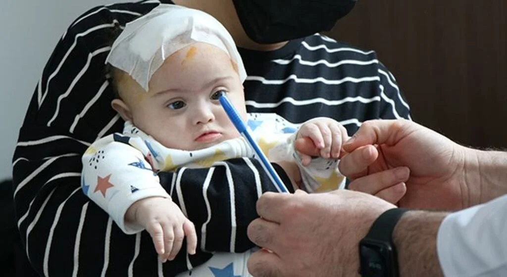 4,5 aylık Niko, ölümcül beyin tümöründen Samsun’da kurtuldu