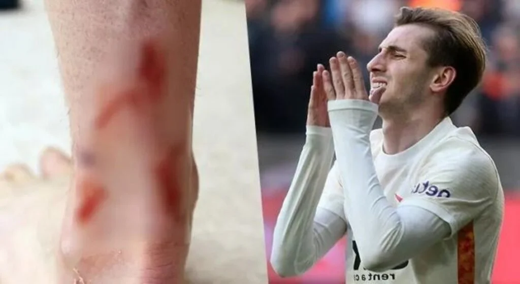 Galatasaray, Kerem'in maç sonundaki ayak durumunu sosyal medya hesaplarından paylaştı. İşte açıklama...