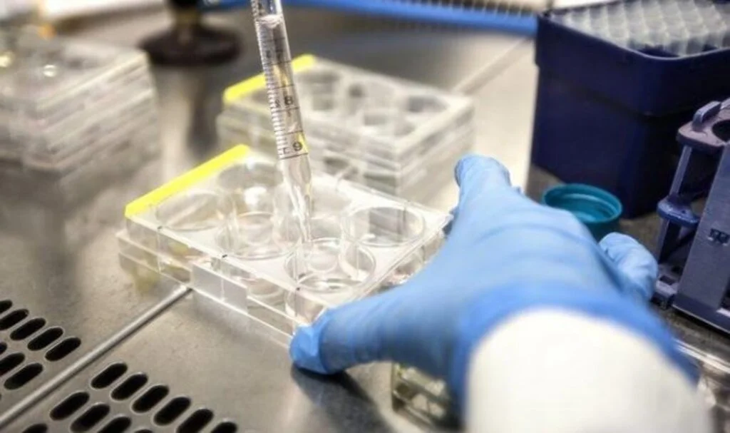 Salmonella virüsü nedir? Salmonella virüsü nasıl bulaşır? Salmonella virüsü belirtileri nelerdir?