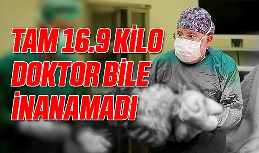 Samsun'da Kadının Karnından 16,9 Kiloluk Dev Kitle Çıktı, 40 Yıllık Doktor Bile Şaşırdı
