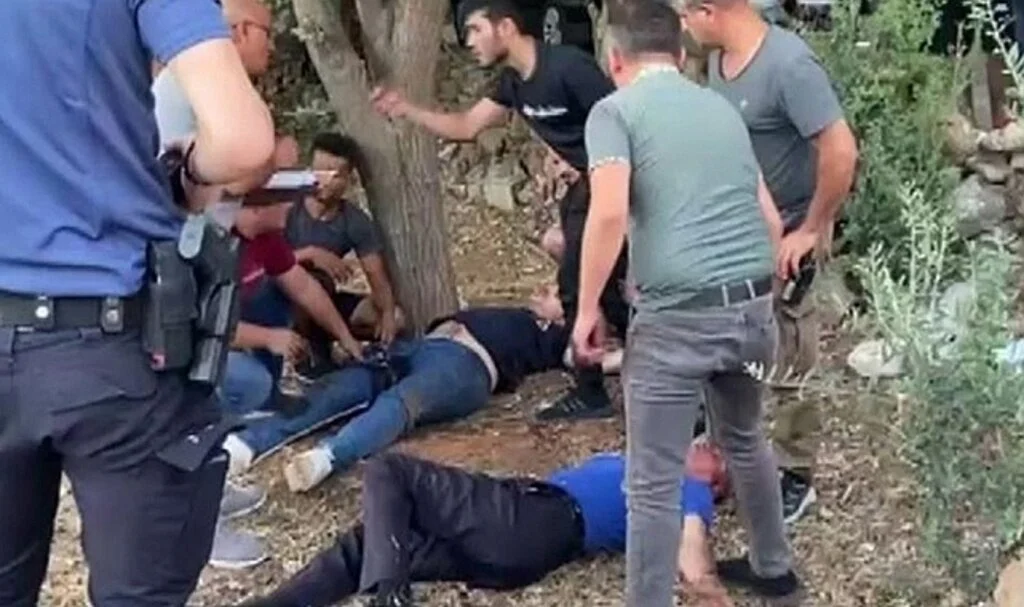 Baba ile üvey oğlu arasındaki tartışmada kan aktı