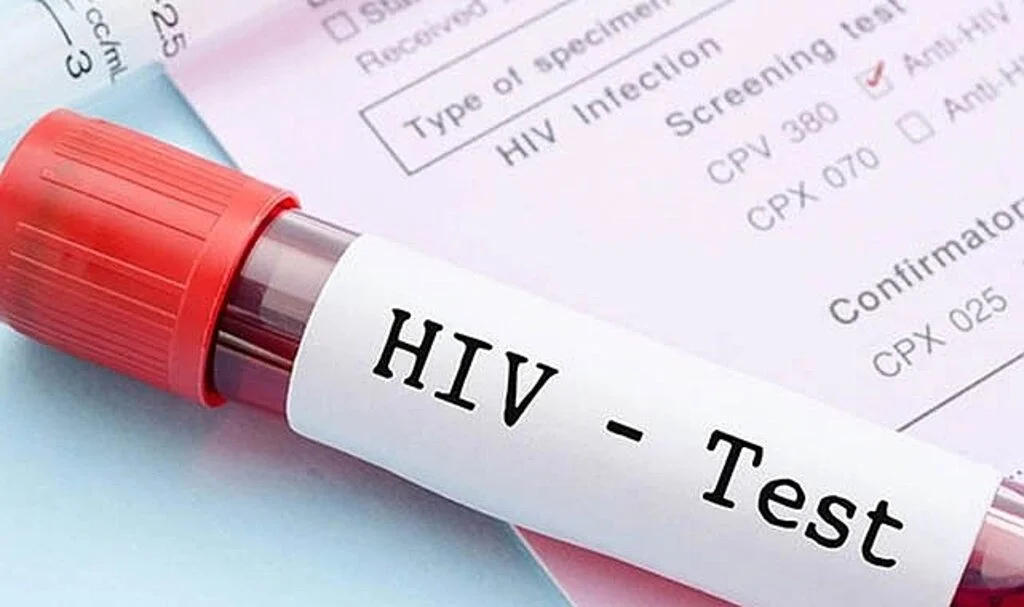 Korkutan AIDS raporu: Yıllık vaka sayısı 1.2 milyonu aşacak