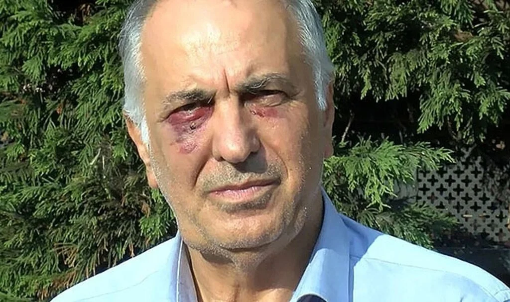 Alevi Vakıfları Federasyonu İkinci Başkanına saldırıyla ilgili 9 gözaltı