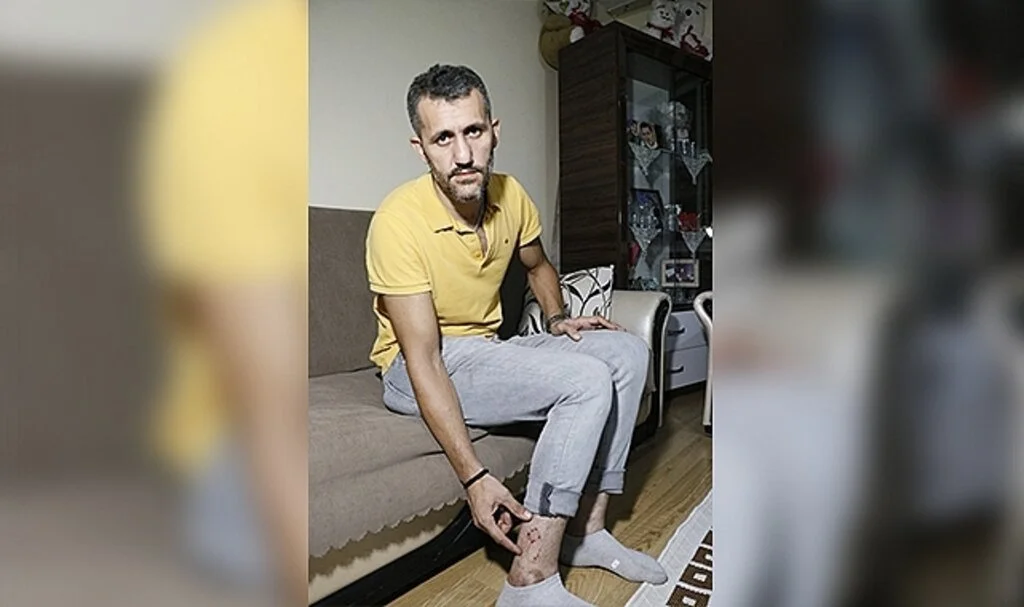 Başıboş köpeler, ailesiyle eve dönen motosikletliye saldırdı