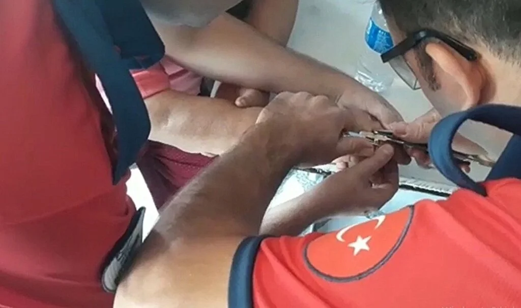 Denedikleri yüzüklerden kurtulamayan kadınların imdadına itfaiye yetişti