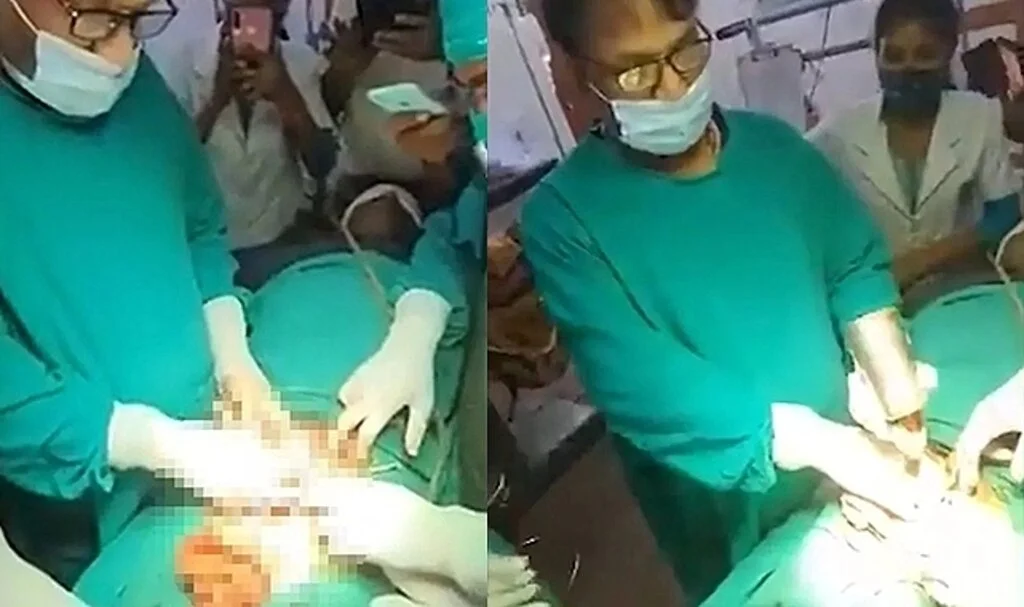 Hastanın midesinden çelik bardak çıktı! Doktorlar ameliyathanede şoke oldu