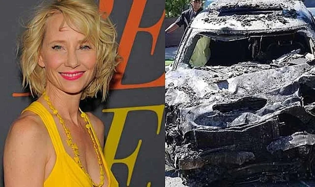 Hollywood yıldızı Anne Heche'in ailesi acı haberi duyurdu: Yaşam destek ünitesi kapatılacak