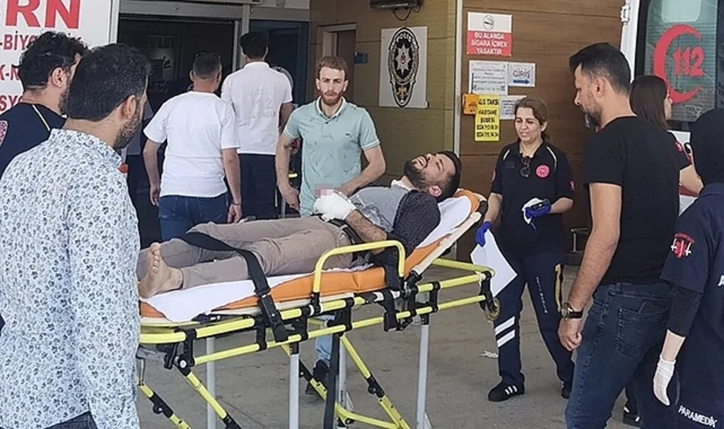 İşçinin parmakları koptu