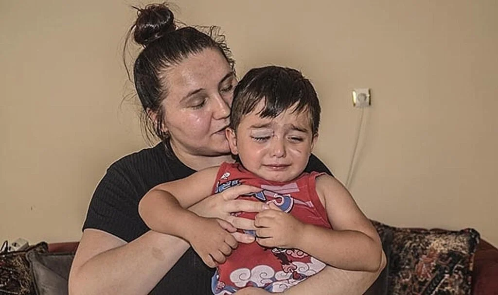 Köpeklerin saldırdığı 3 yaşındaki çocuğun yüzü parçalandı
