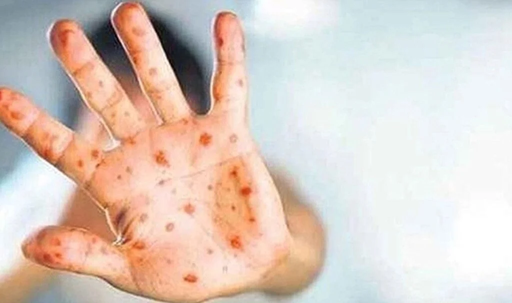 Korkutan uyarı geldi: Domates virüsüyle ilgili yeni detay!