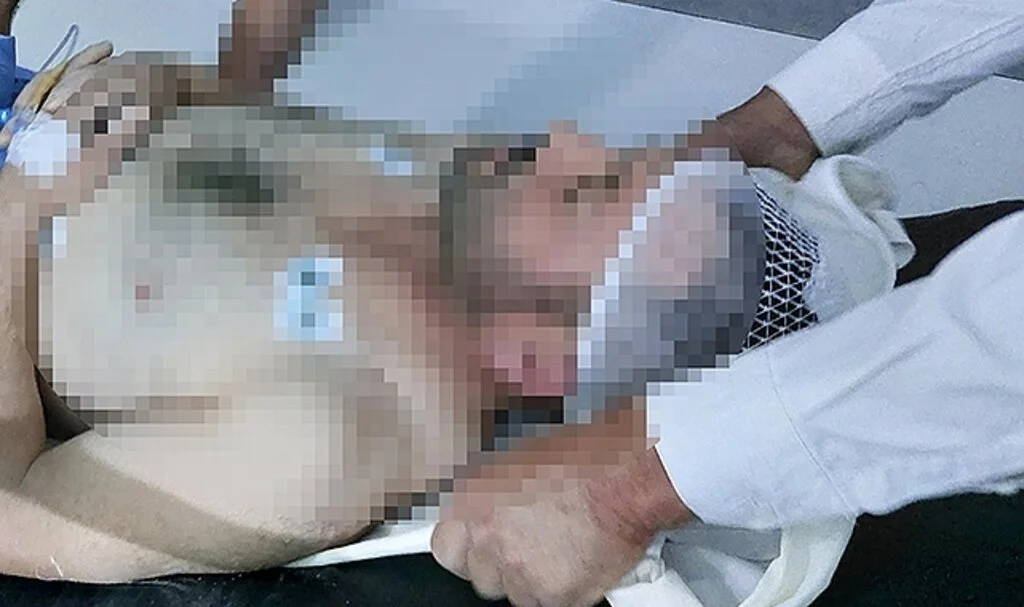 Samsun'da minibüsün üzerinden düşen şoför ağır yaralandı