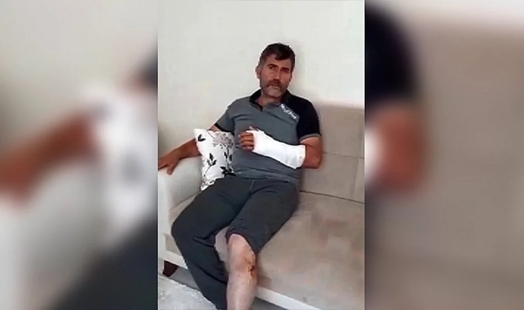 Öldü sandığı ayıdan güreşerek kurtuldu