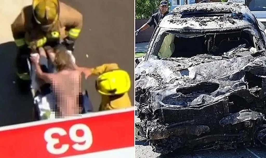 Ölümden döndü! Alev topuna dönen araçtan çıkarılan ünlü oyuncu, entübe edildi