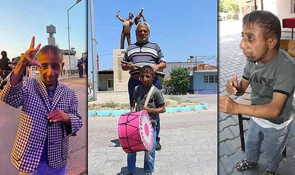 ‘Parmak çocuk’ Sefa Tirit hayatını kaybetti