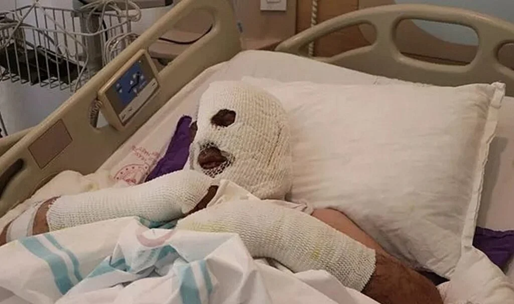 Tıkalı lavaboya kimyasal döktü, olanlar oldu: Kimse bilmediği işi yapmasın