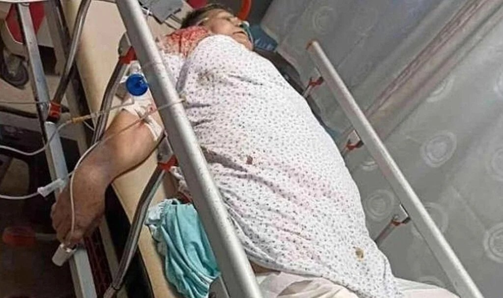 Zayıflamak isteyen 2 çocuk annesi kadın feci şekilde hayatını kaybetti