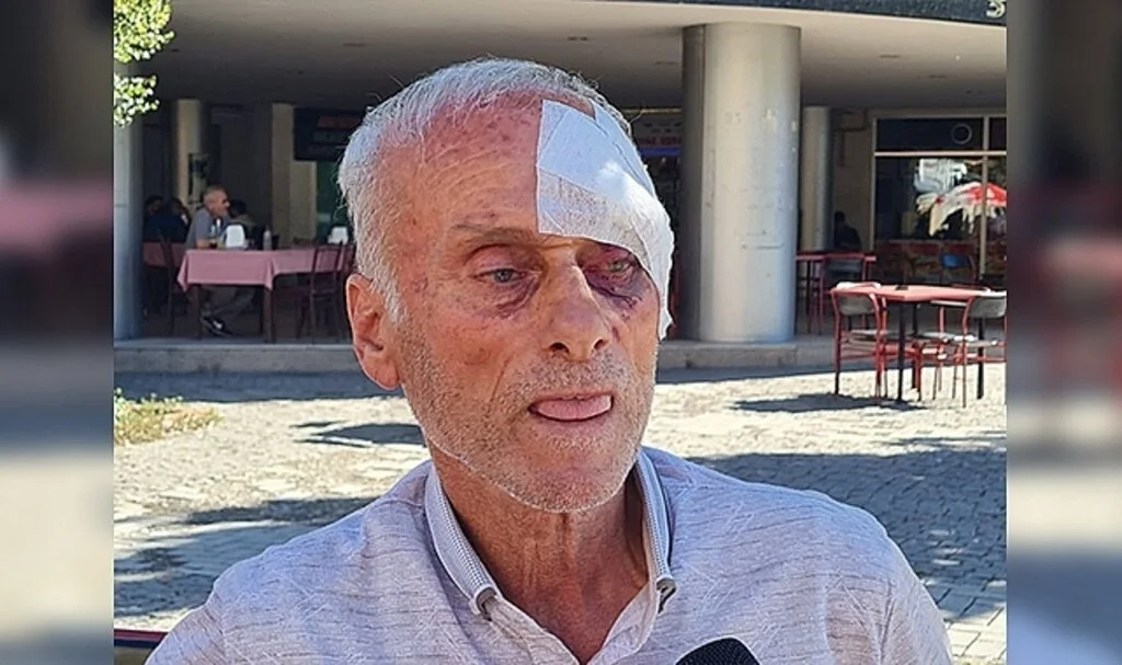 57 yıllık CHP üyesi parti binasında darp edildi