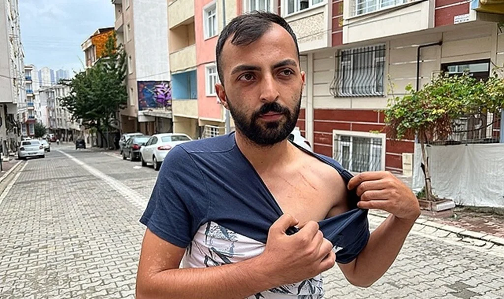 Borç verdiği parayı geri isteyince öldüresiye dayak yedi